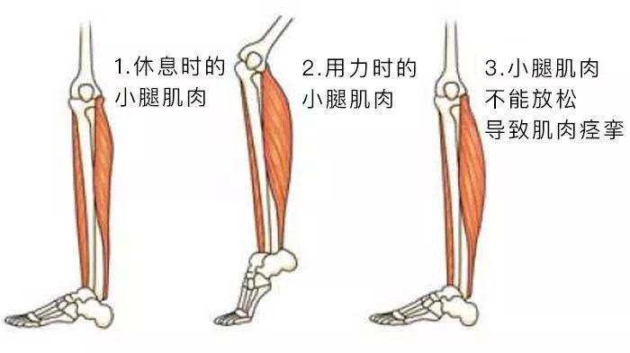 运动为什么抽筋,运动时容易抽筋是什么原因