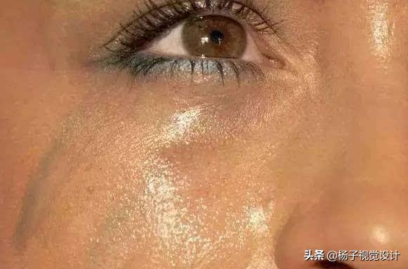 毛孔粗大油性皮肤长痘痘怎么解决,油性皮肤长痘痘毛孔粗大怎么改善