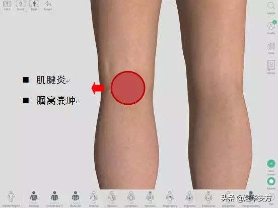跑姿不对造成的膝盖疼多久能好,膝盖不同位置疼痛代表什么