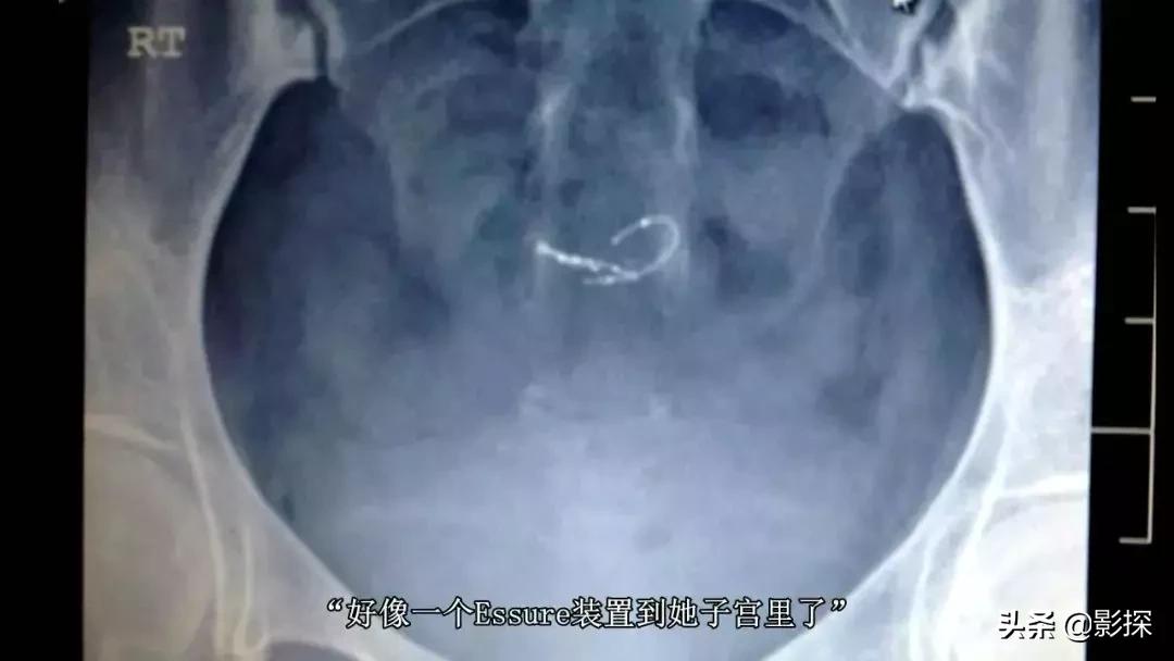 网飞利润,网飞靠什么盈利