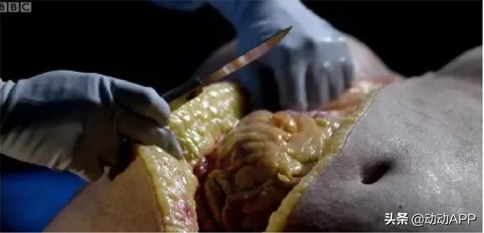 腰肥一寸命短十年,腰长一寸寿减十年