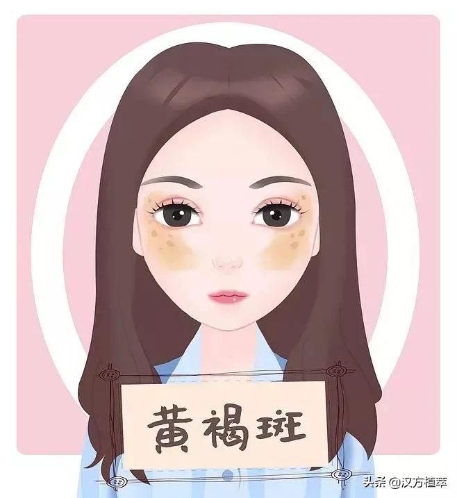 做斑一年了皮肤有点红,做斑后会变得很老吗