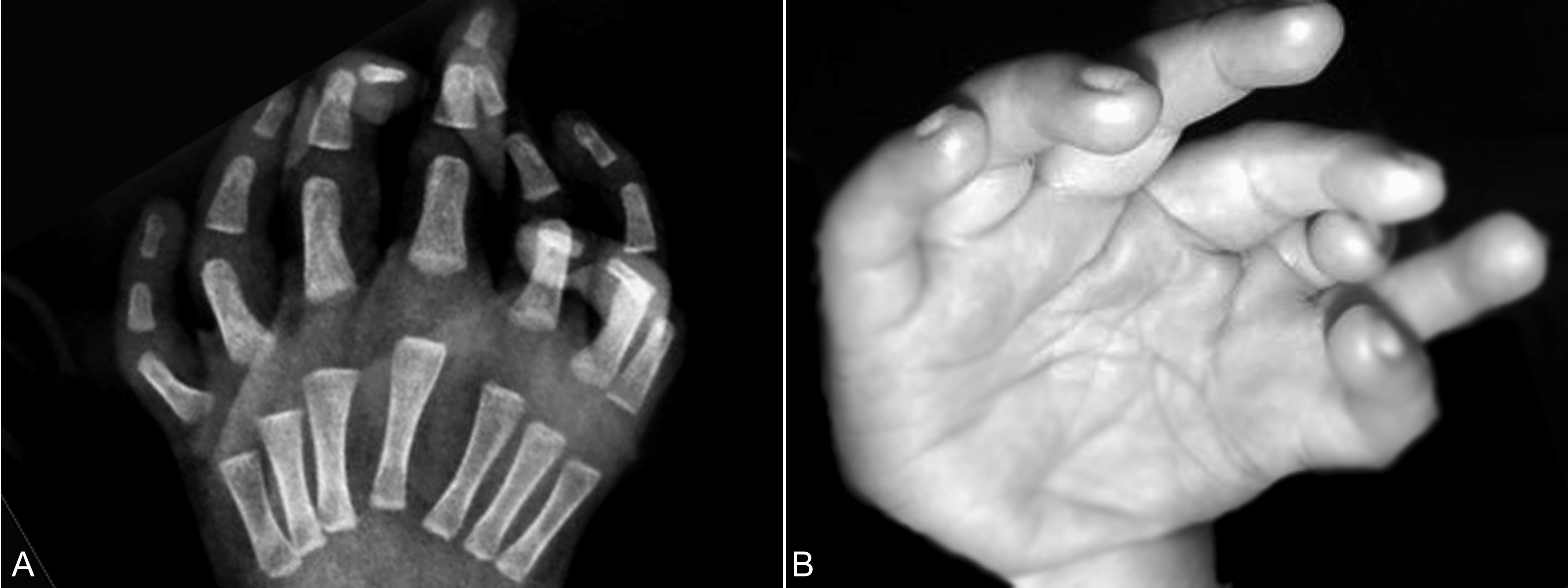 明明白白做b超,明明白白做超声