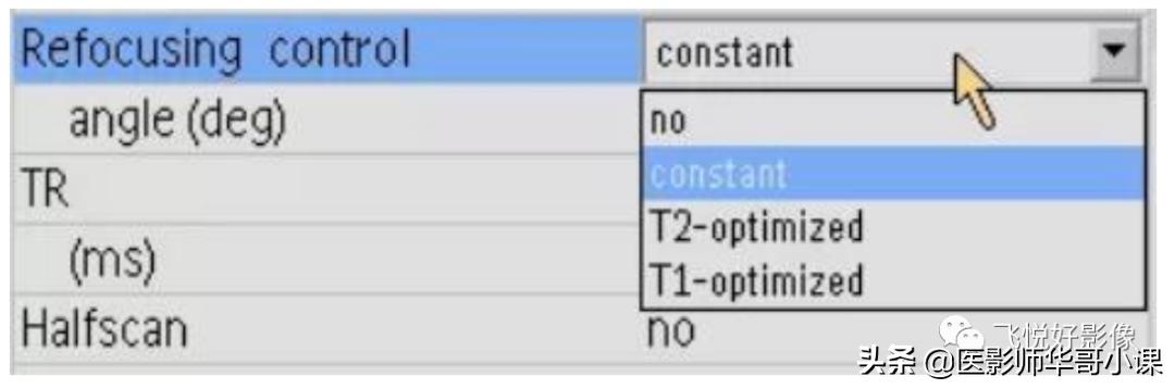飞利浦磁共振序列参数解读,飞利浦磁共振快速扫描方案指南