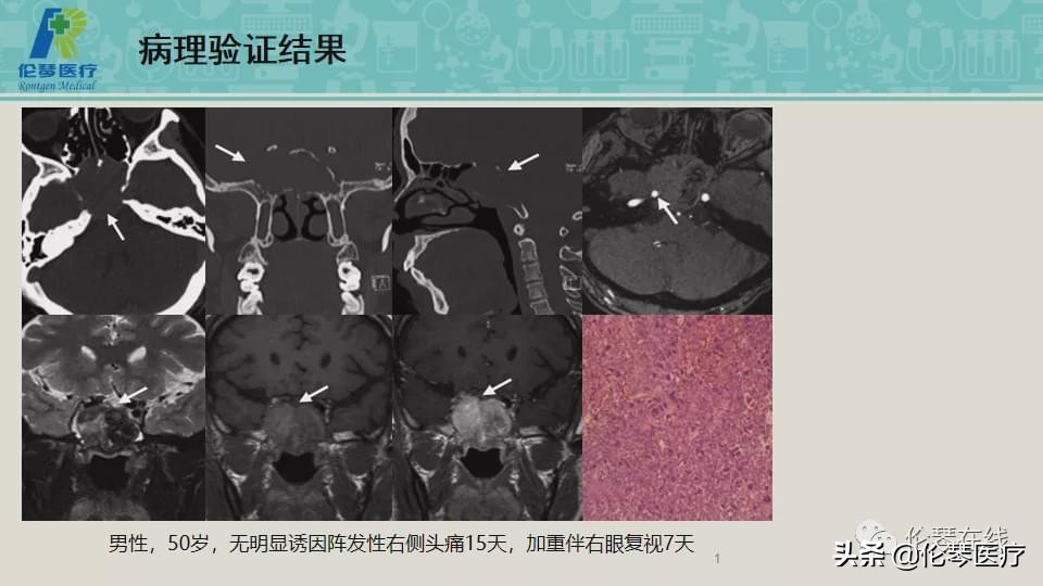 上海教授詹松华,上海曙光医院詹松华简介