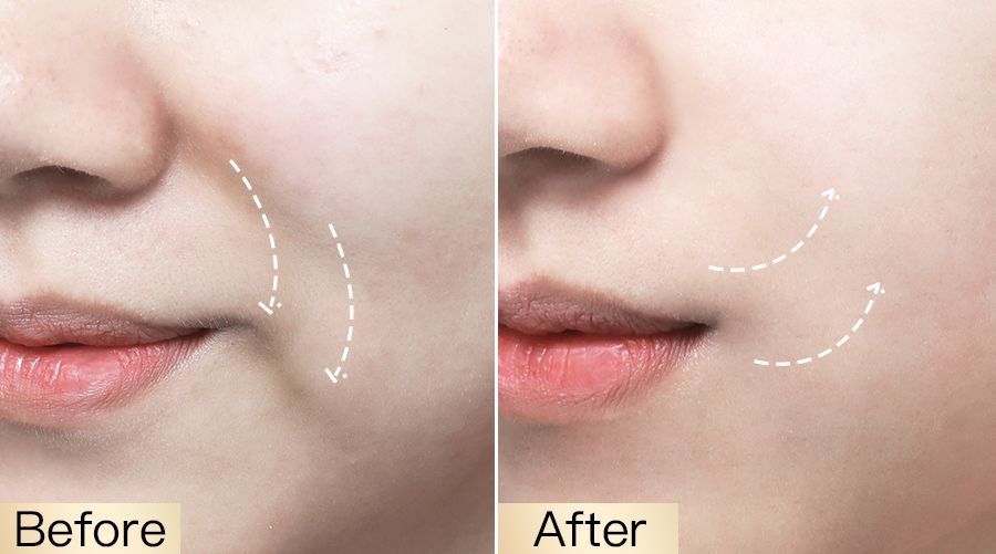 影后打call,影后打call视频