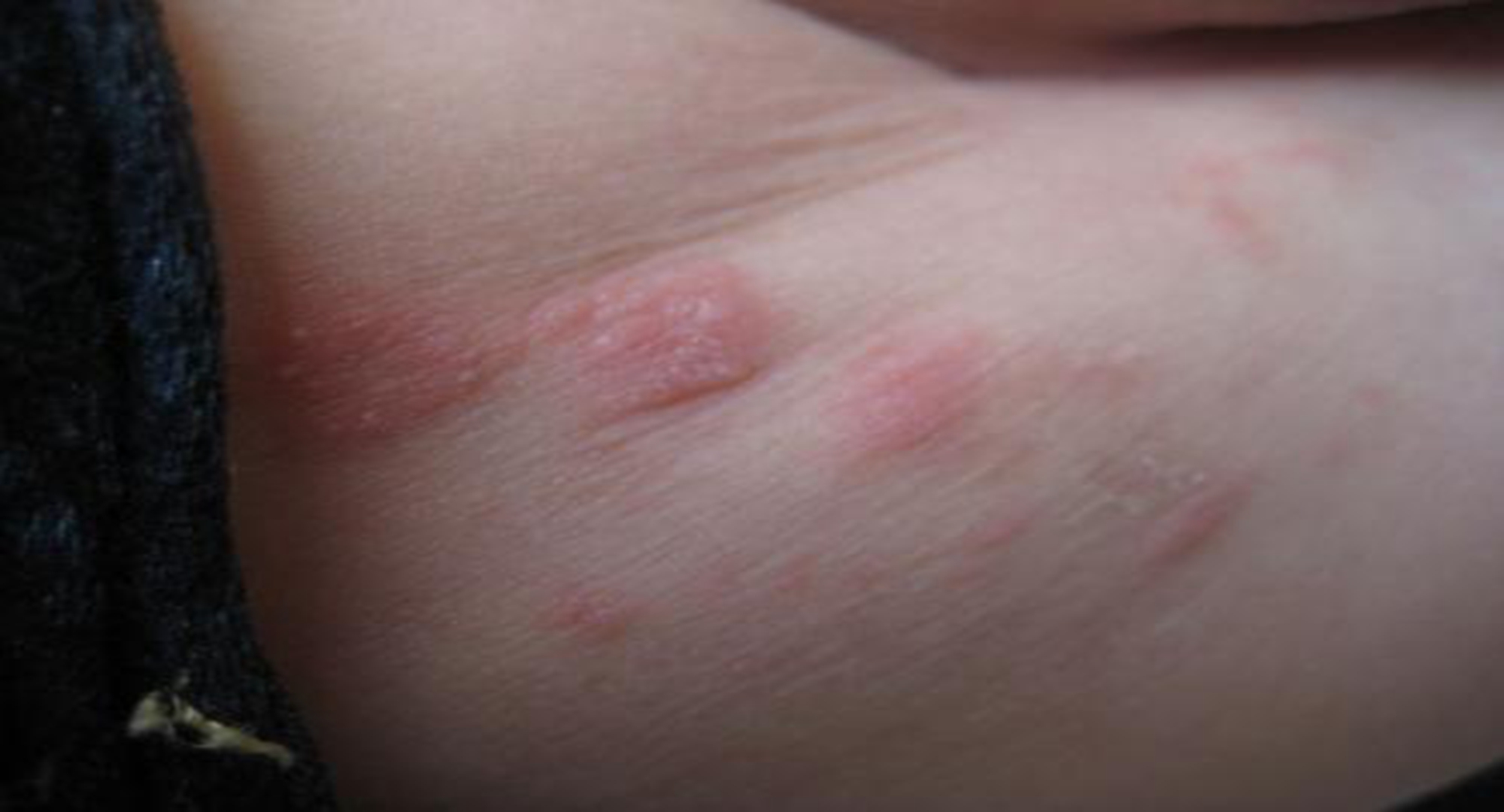 女宝宝*处私**该如何清洗？爽身粉是个错误选项，新手宝妈千万别犯傻