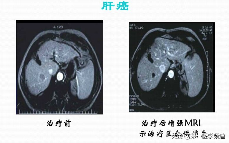 「医影传声」上海交通大学医学院附属瑞金医院卢湾分院放射科主任