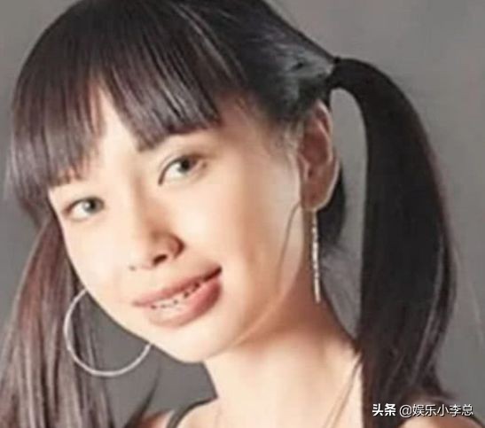 杨颖戴牙套是什么时候,杨颖整牙为什么不戴隐形牙套