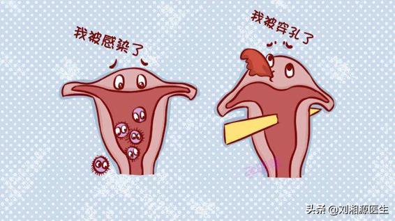 宫腔粘连合并妊娠,宫腔粘连容易导致生化妊娠吗