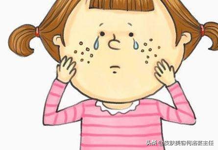 反复长痘留下顽固痘印用什么精华,顽固痘印如何祛除最有效果的方法