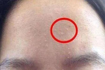 床单久睡不晒螨虫“成堆”？教你1招，不用洗不用晒，轻松除螨虫