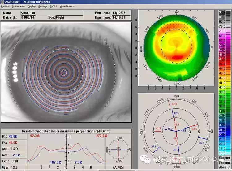 如何选择角膜塑形镜的品牌,怎么选角膜塑形镜的参数