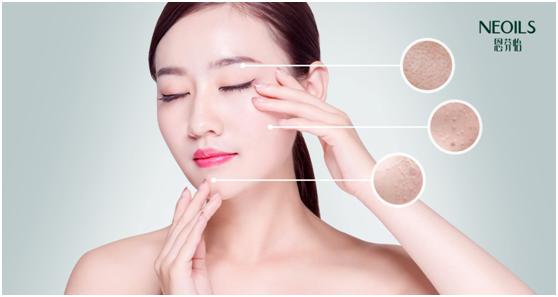 肌肤泛红有红血丝发热,肌肤泛红有红血丝怎么修复