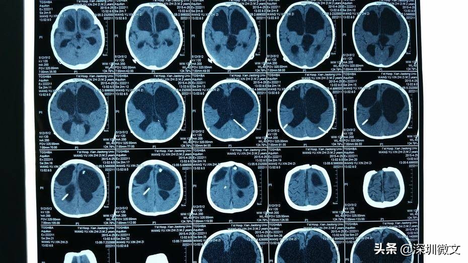 x光ct和核磁共振分别多少钱,ct与x光与核磁共振的区别是什么