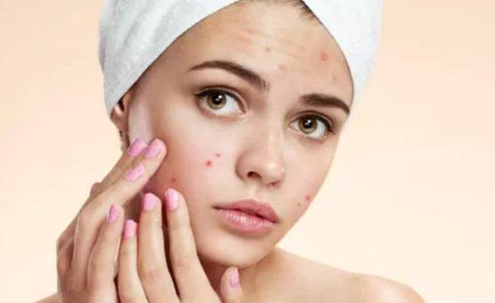 一直长痘留疤怎么办,长痘留疤怎么恢复