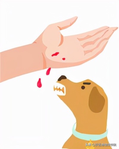 被猫狗抓伤咬伤怎么办,被猫狗抓伤第一步应该怎么处理