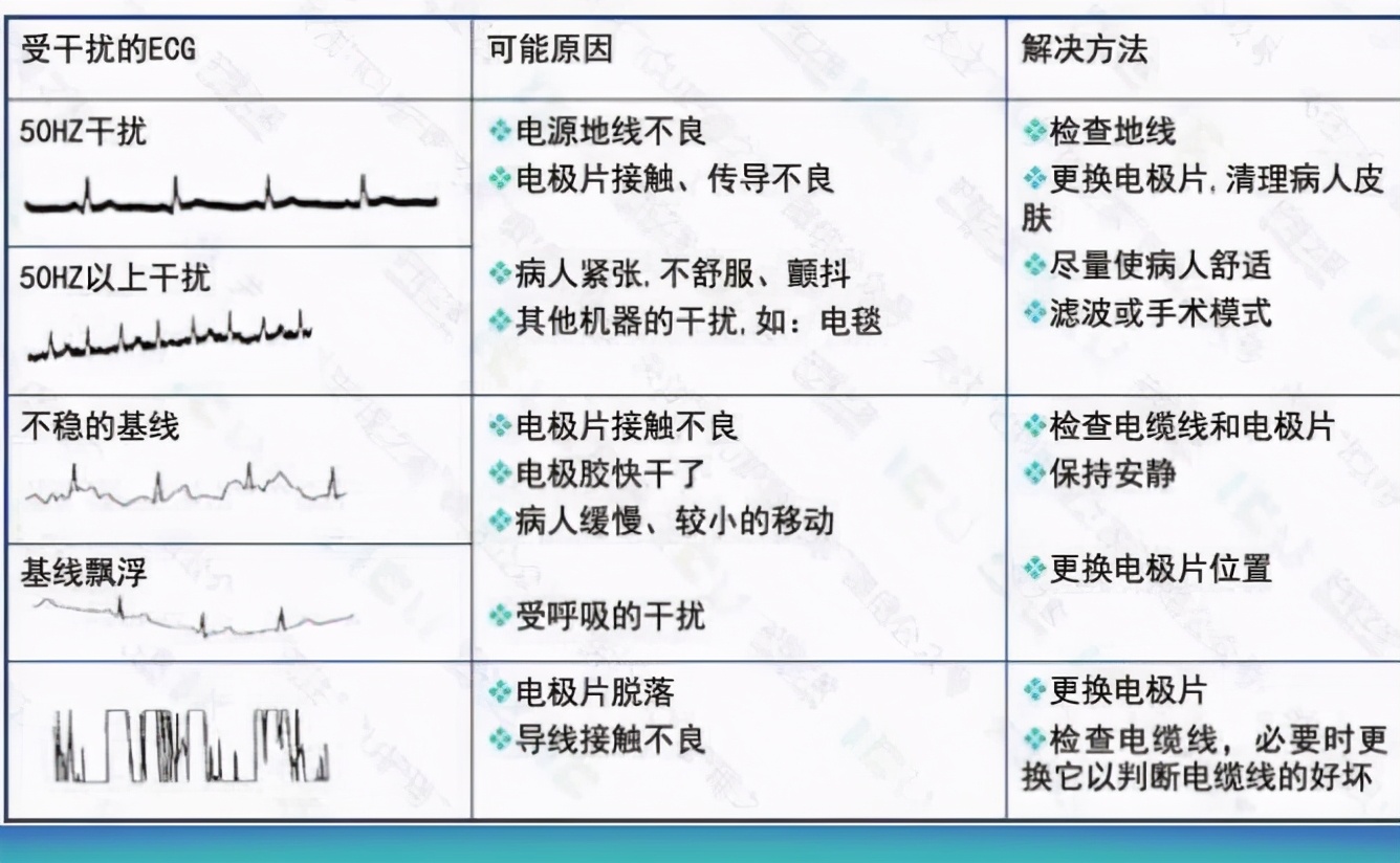 心电监护使用ppt,心电监护使用时间计算