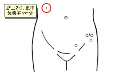 胃下垂十二指肠淤滞,治疗胃十二指肠溃疡的最佳穴位