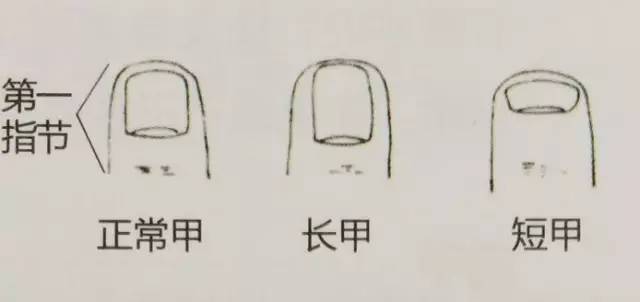 指甲有四种现象很危险,指甲反映身体状况