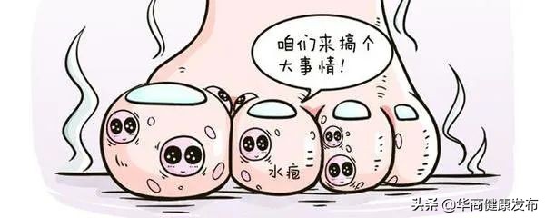 预防阴道炎，你做对了吗？