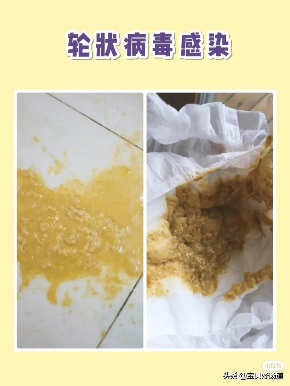 宝宝拉肚子和吃药有没有关系,乱吃治拉肚子的药有什么后果