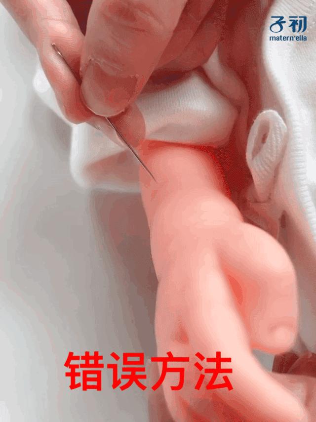 被油烫伤怎么紧急处理,宝宝烫伤怎么简单护理