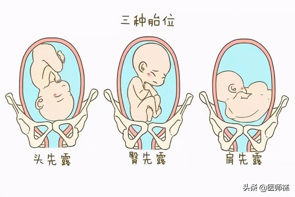 剖宫产对胎儿有什么影响,为什么剖宫产会大出血