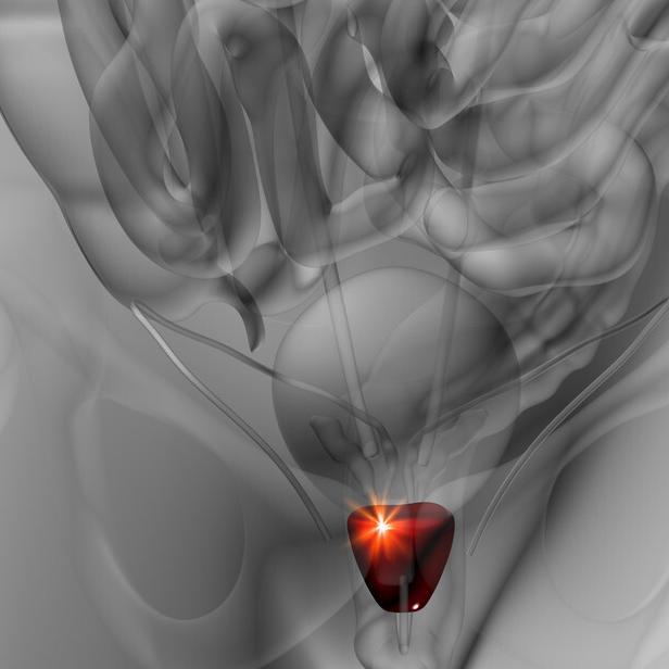 会阴隐隐发痛前列腺炎需要打针么,会阴胀痛是不是前列腺炎