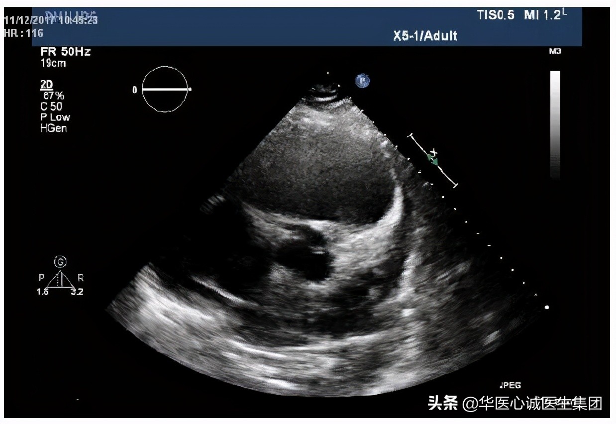 杨颖局部图,杨颖早期下颌宽大