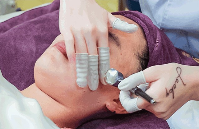 福州如何有效祛痘坑,福州快速祛痘