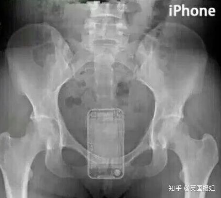 用命换钱的“骡子，是如何把大量*品毒**塞进自己体内的？