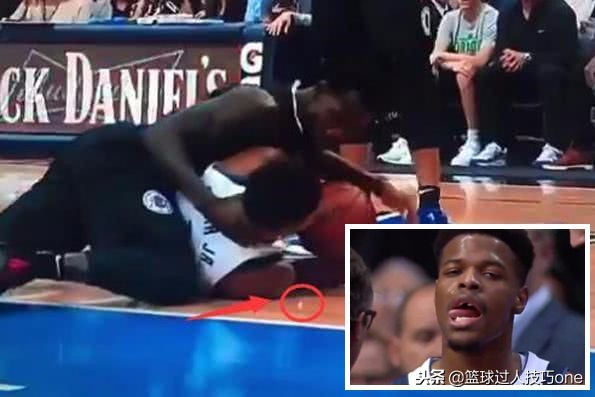 nba球员戴的牙套用什么做的,nba球星牙套怎么戴