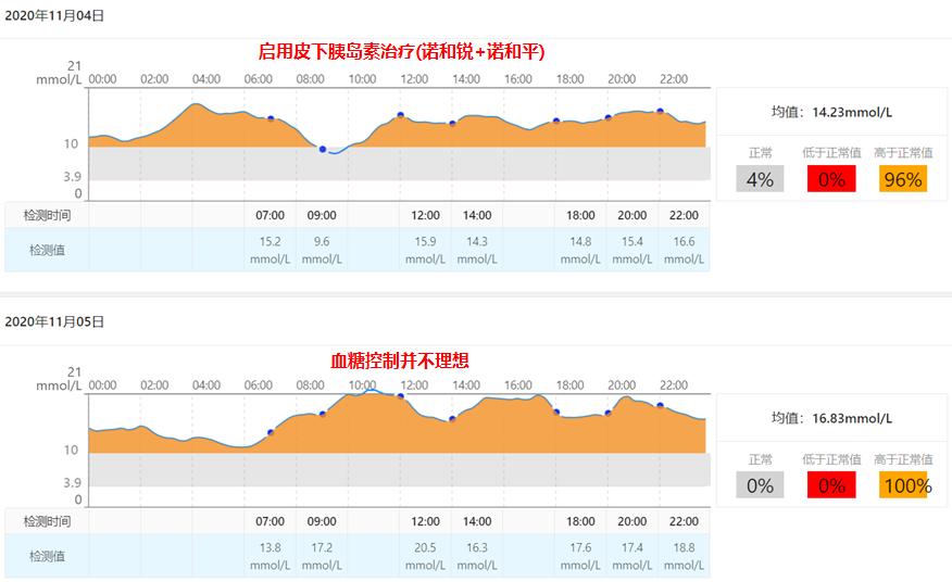 t1d血糖波动特点,t1dm糖尿病能治疗吗