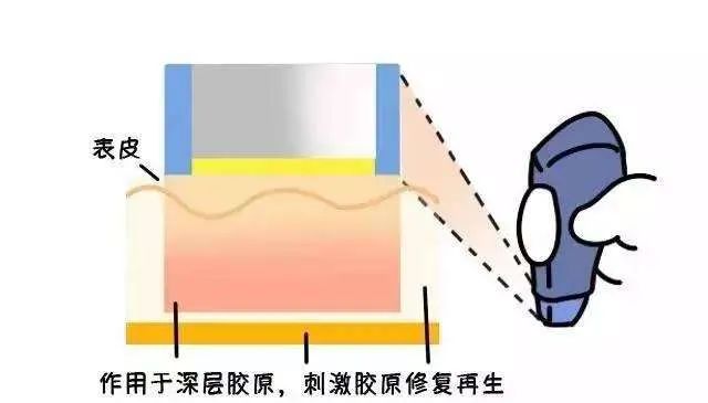 抗衰老的重要物质胶原蛋白肽,抗衰老成分胶原蛋白