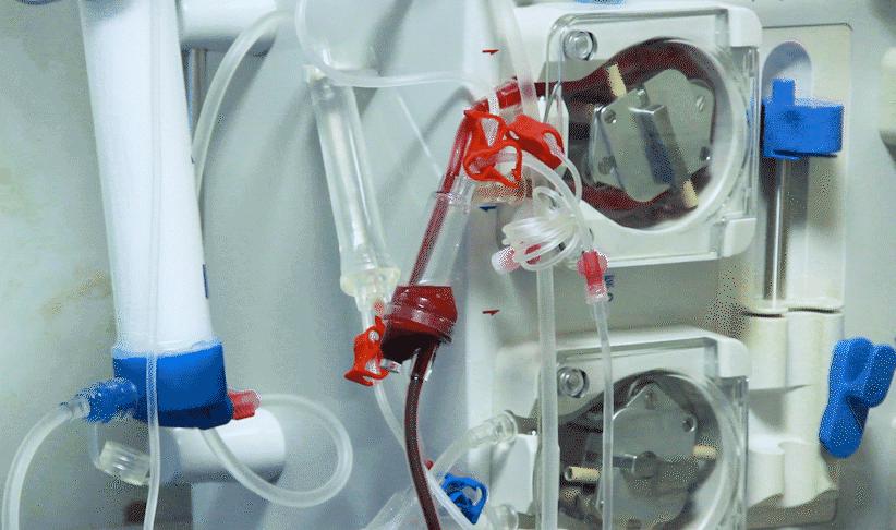 生物制剂治疗类风湿多长时间见效,生物制剂治疗类风湿多久能稳定