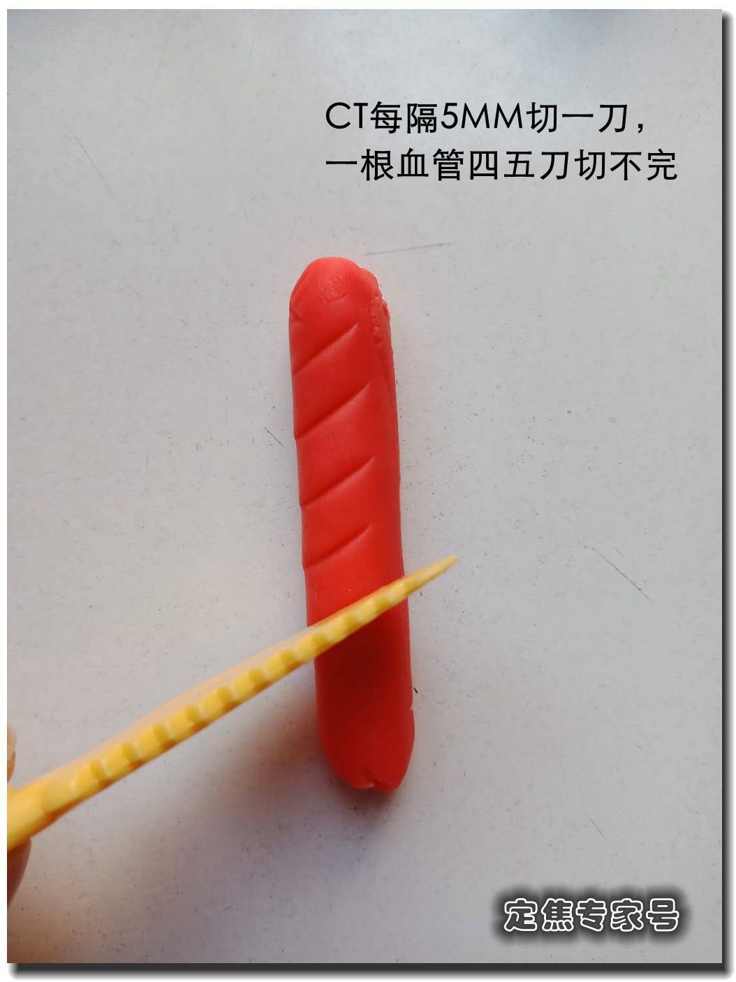 体检报告出是肺大泡就是肺结核吗,体检查出是肺大泡可信吗