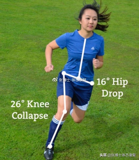 前交叉韧带损伤保守康复训练方法,前交叉韧带损伤康复训练的方法