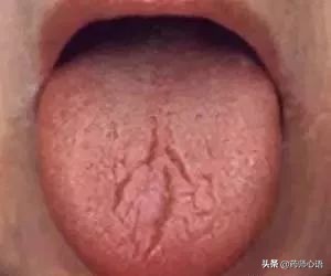 舌头反映了身体的哪些器官,舌头出现信号对身体有什么危险