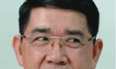 如何快速缓解眼睛疲劳护眼妙招,眼睛干涩疲劳是什么原因中医治疗