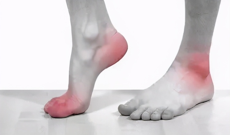 痛风患者饮食不宜吃哪些食物,痛风患者哪些食物不能吃或少吃