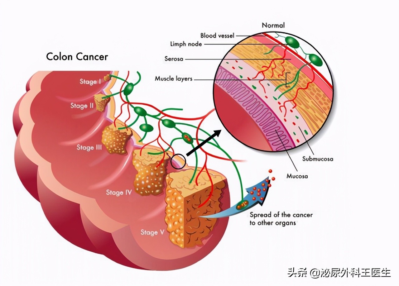 难以启齿的病是什么病,难以启齿的病症有哪些