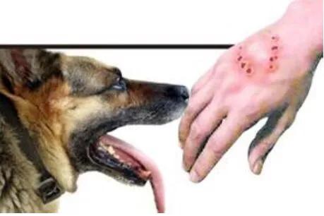 被小孩子咬了需要打狂犬疫苗吗,被别的小孩咬到可以打狂犬疫苗吗