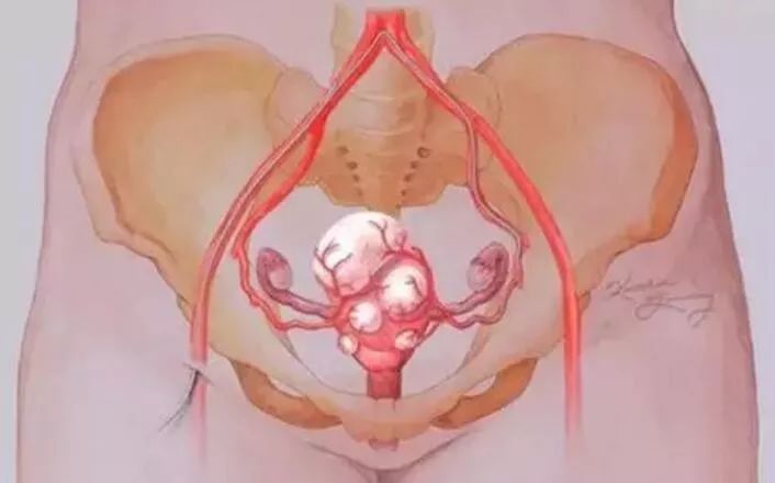 没做过人流,为何也成为输卵管堵塞的受害者?