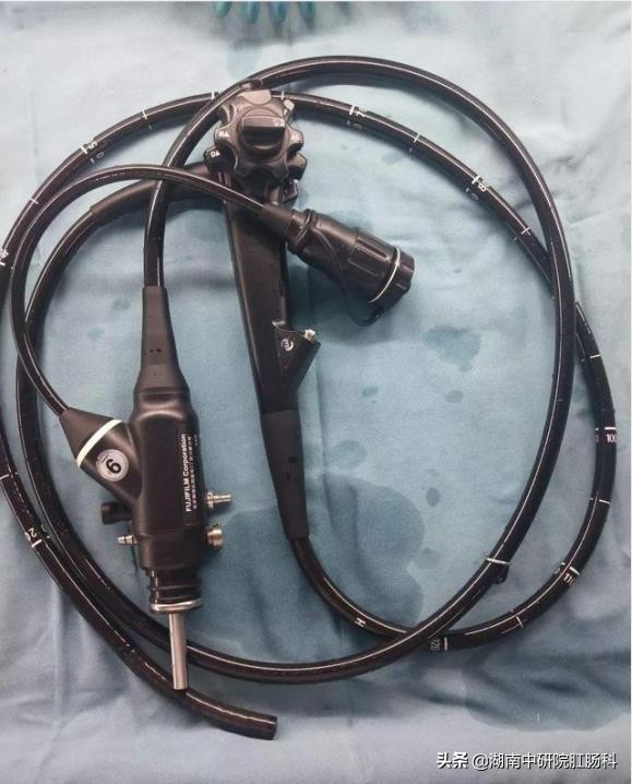 肠镜检查缓解尴尬的3个常识,关于胃肠镜检查你最关心的问题