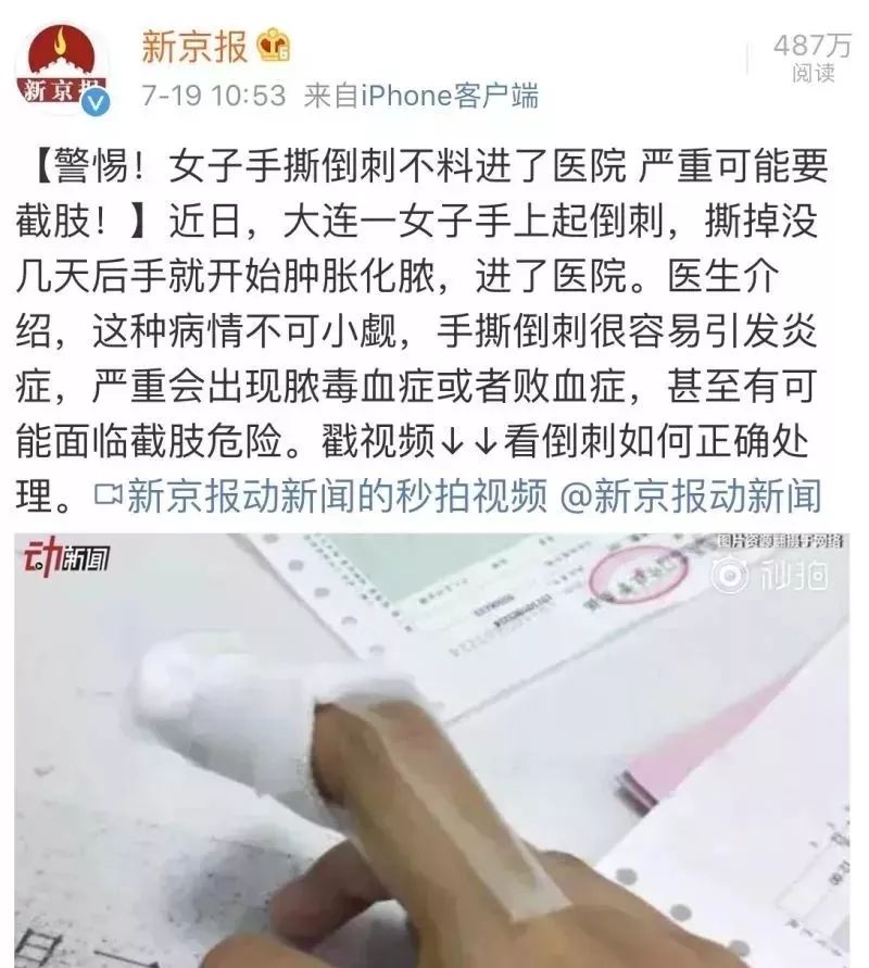 娃指甲上有白点是怎么回事,孩子指甲横纹有白点