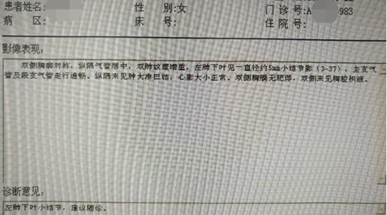 50岁女肺部8毫米结节治疗过程,女士肺结节康复