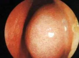 2个常见的儿童用药误区家长必看,家里常备这8种药孩子生病不慌乱