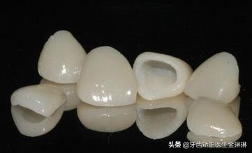 烤瓷牙不密合怎么办,烤瓷牙边缘不密合了怎么处理