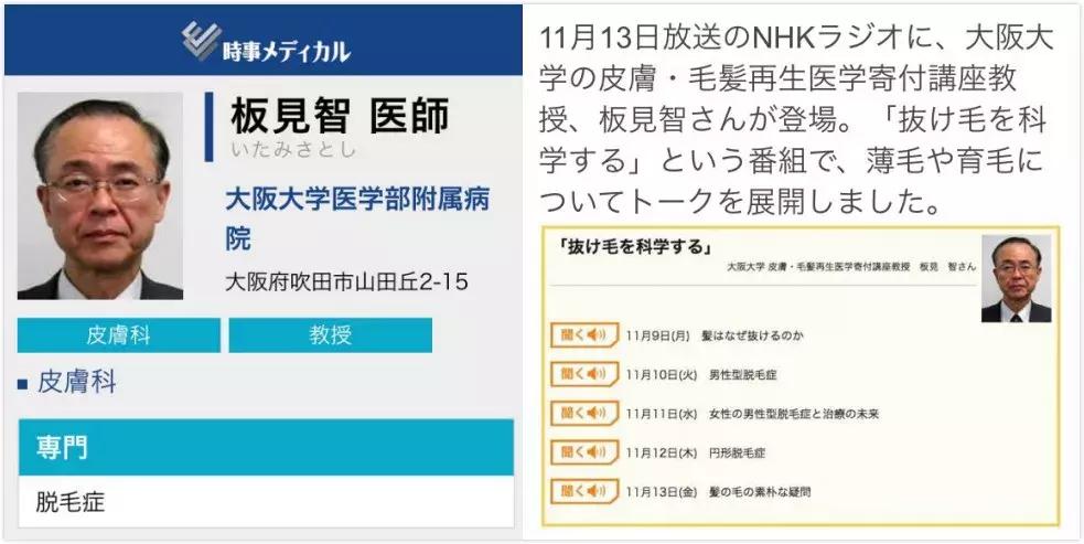 脱发真的很影响颜值么,脱发除了遗传还有什么原因